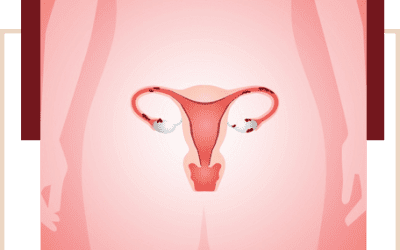 O que você precisa saber sobre endometriose